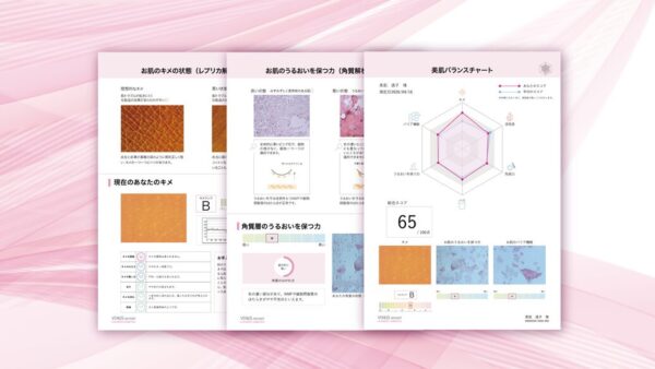 ヴィーナスレポート