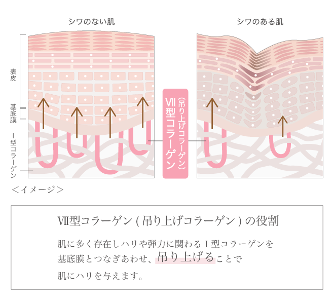 Victline   Brands   シャンソン化粧品